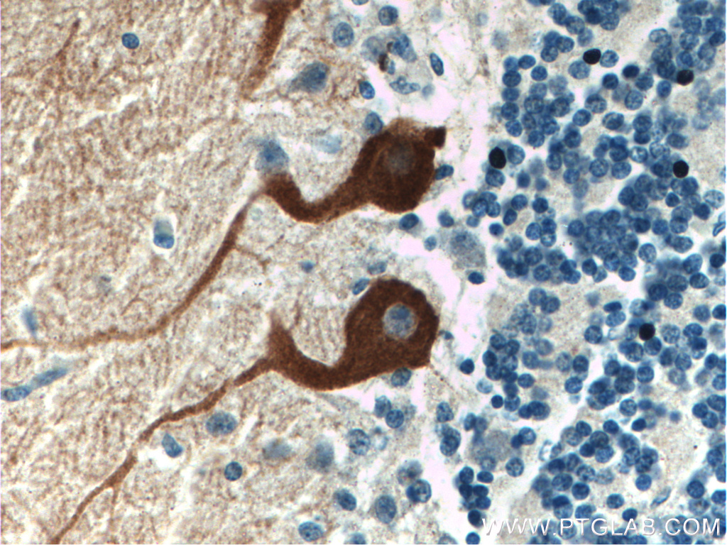 IHC staining of human cerebellum using 16624-1-AP