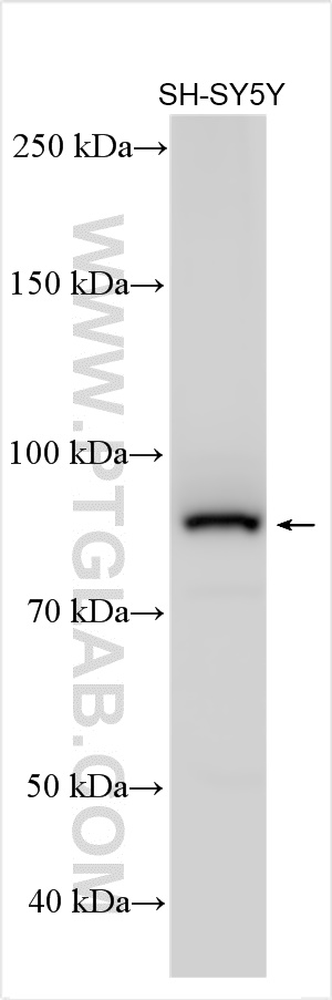 WB analysis using 12458-1-AP