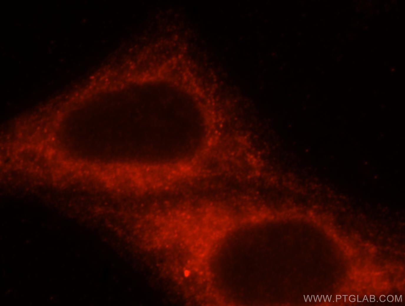 IF Staining of HepG2 using 15457-1-AP