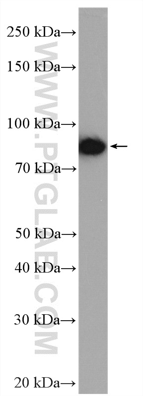 WB analysis of rat liver using 15457-1-AP