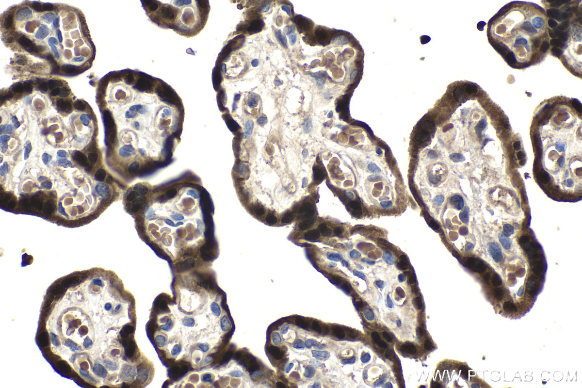 IHC staining of human placenta using 11419-1-AP