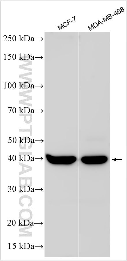 Various lysates were subjected to SDS PAGE followed by western blot with 13917-1-AP (HORMAD1 antibody) at dilution of 1:6000 incubated at room temperature for 1.5 hours. WB analysis using 13917-1-AP