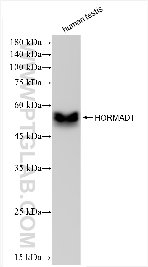 WB analysis of human testis using 84003-5-RR