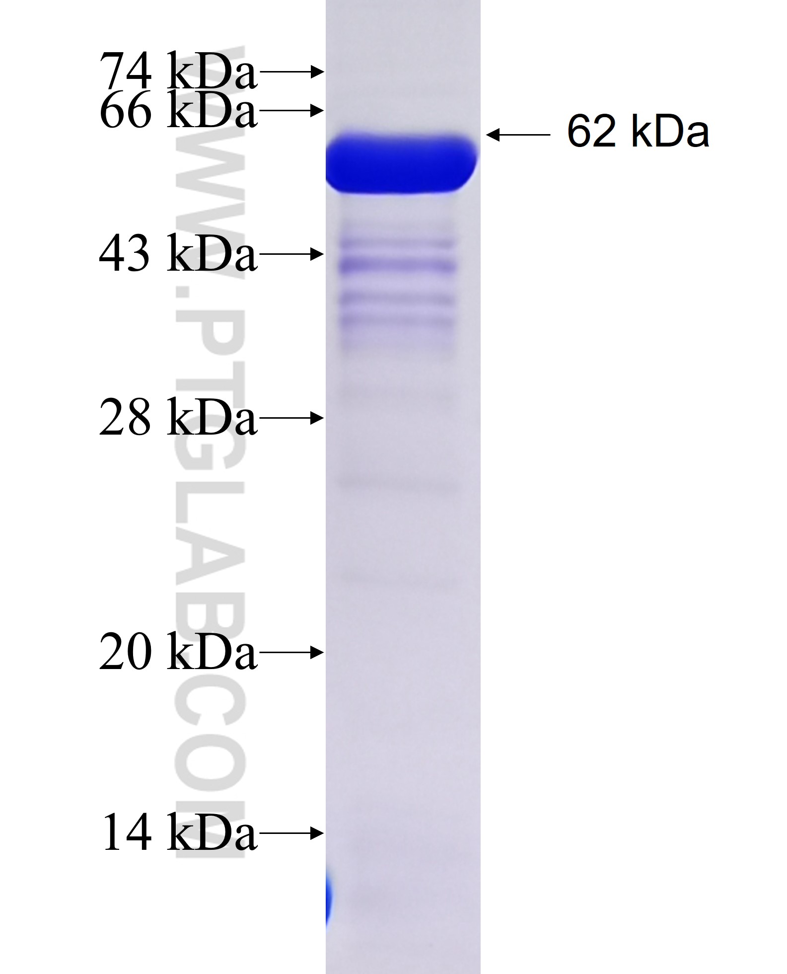 HORMAD1 fusion protein Ag28316 SDS-PAGE