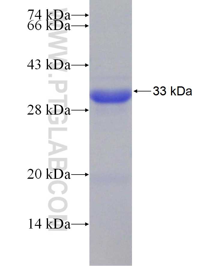 HORMAD1 fusion protein Ag29879 SDS-PAGE HORMAD1 fusion protein Ag29879 SDS-PAGE