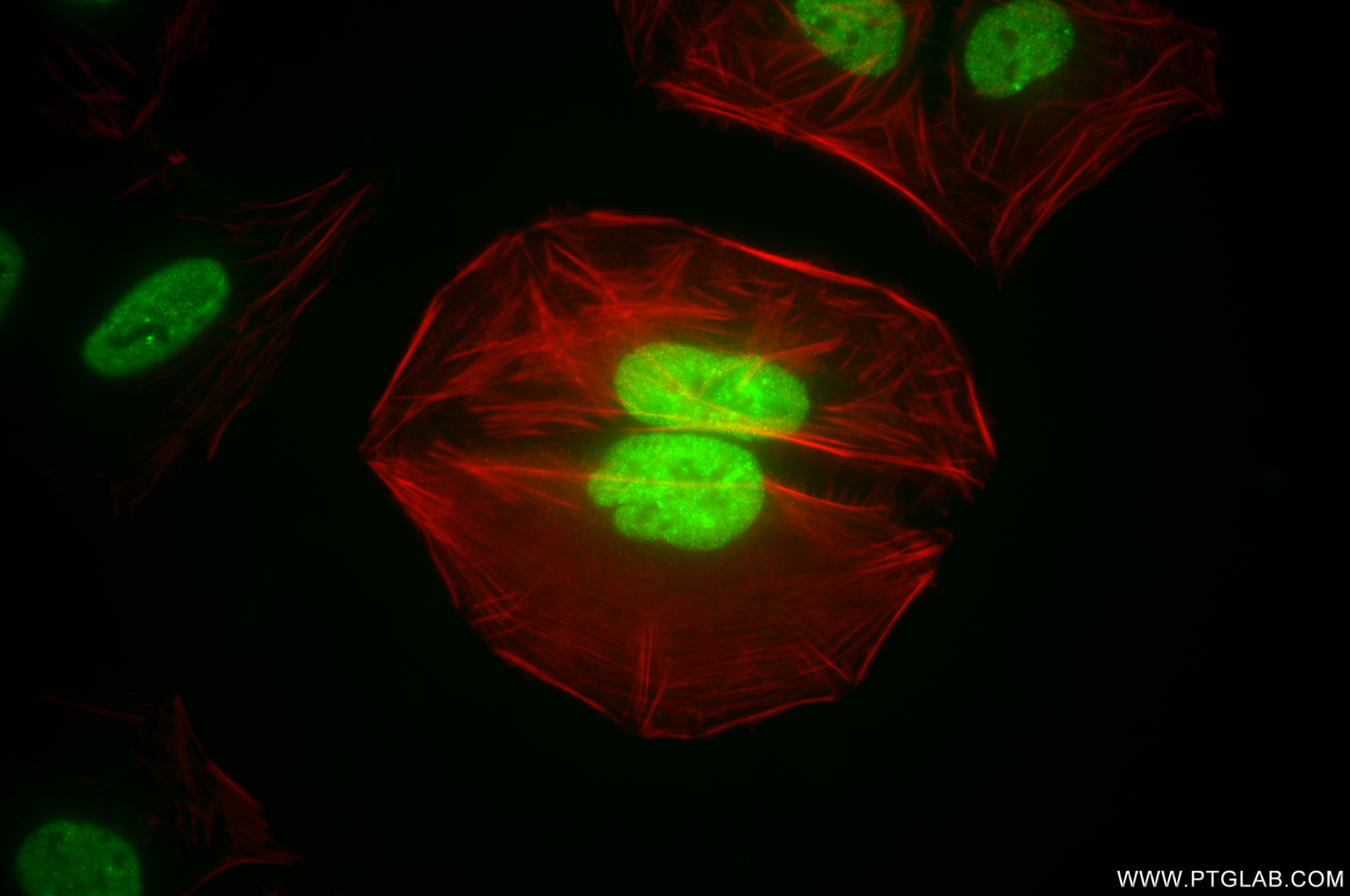 IF Staining of U2OS using 85951-2-RR (same clone as 85951-2-PBS)