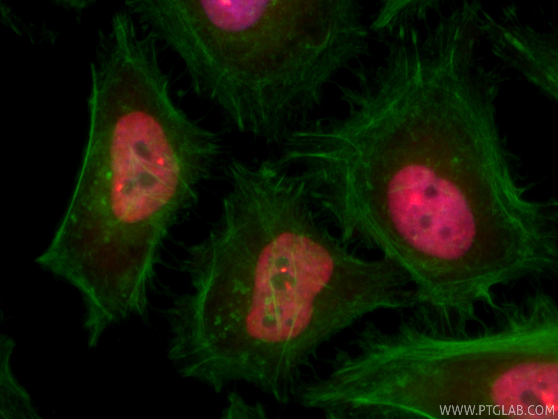 IF Staining of HeLa using CL594-85951-2 IF Staining of HeLa using CL594-85951-2