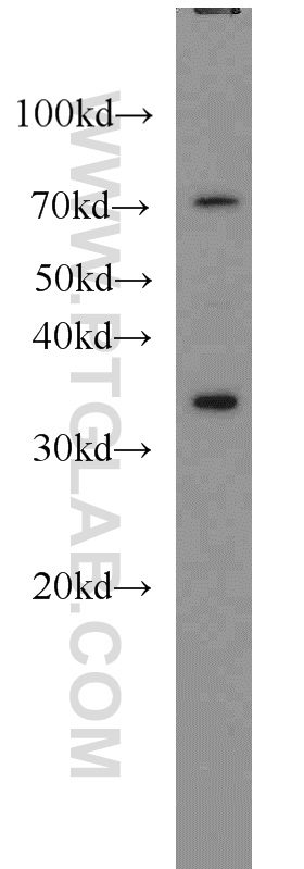 WB analysis of HeLa using 55495-1-AP