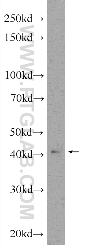 HOXA2