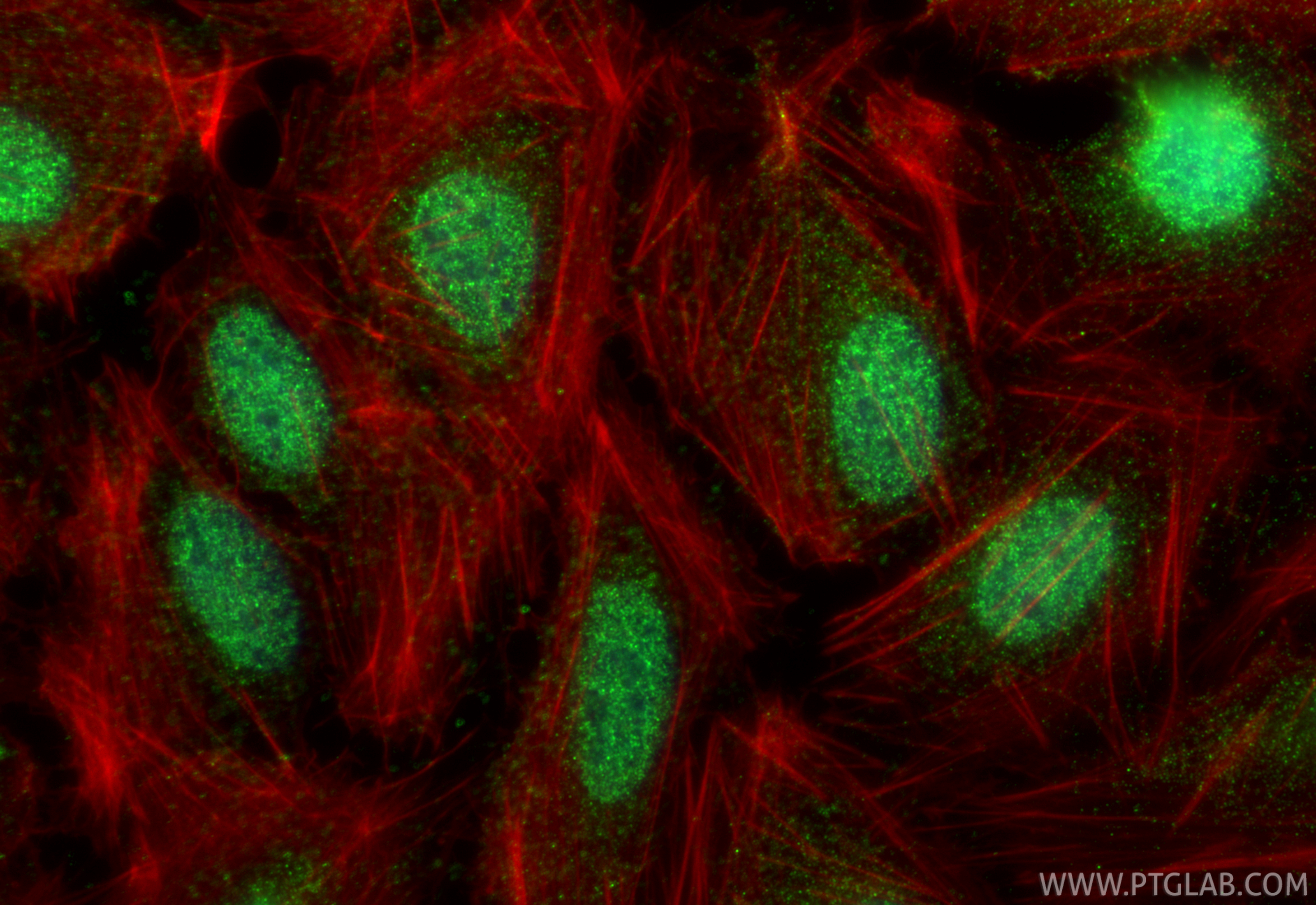 Immunofluorescent analysis of (4% PFA) fixed U2OS cells using HOXA5 antibody (27622-1-AP) at dilution of 1:400 and CoraLite®488-Conjugated Goat Anti-Rabbit IgG(H+L) (<a class='green' href='/productredirect?CatalogNo=SA00013-2' target='_blank'>SA00013-2</a>), CL594-Phalloidin (red). IF Staining of U2OS using 27622-1-AP
