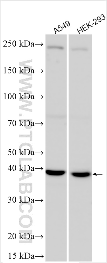 WB analysis using 27622-1-AP