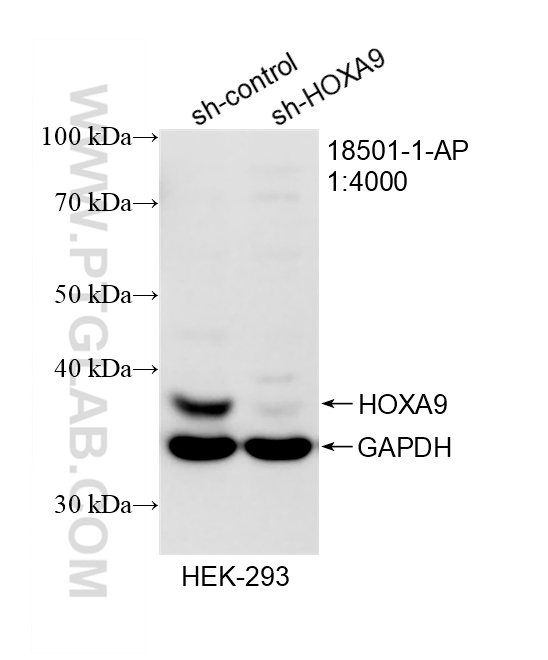 WB analysis of HEK-293 using 18501-1-AP WB analysis of HEK-293 using 18501-1-AP