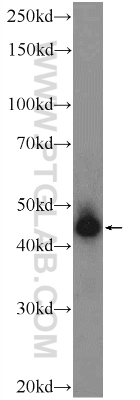 WB analysis of mouse brain using 21653-1-AP