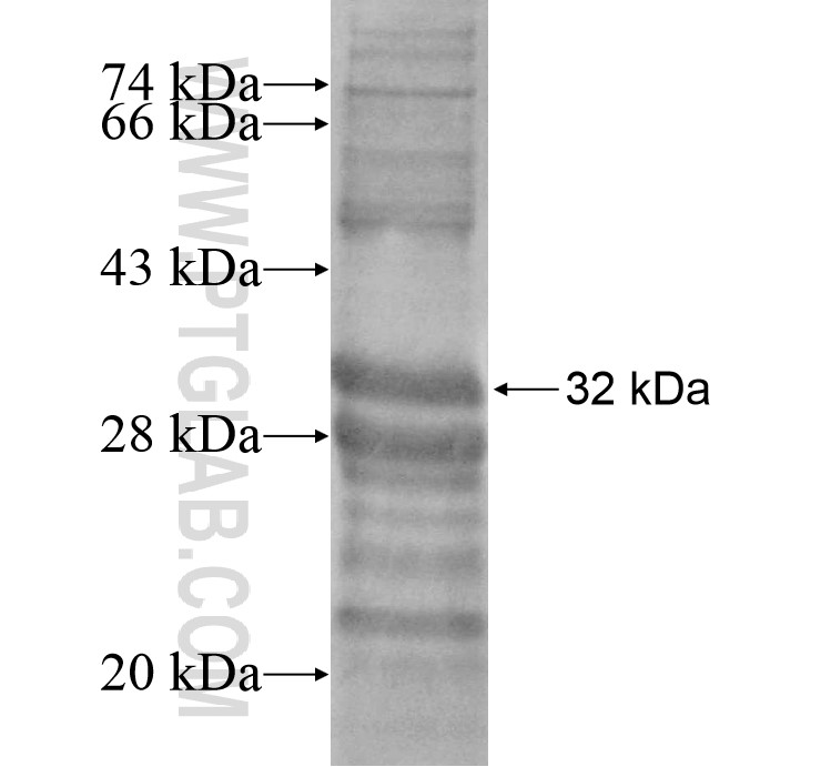 HOXB1 fusion protein Ag16759 SDS-PAGE HOXB1 fusion protein Ag16759 SDS-PAGE
