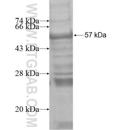 HOXB13 fusion protein Ag8476 SDS-PAGE HOXB13 fusion protein Ag8476 SDS-PAGE