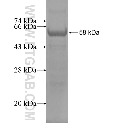 HOXB2 fusion protein Ag13634 SDS-PAGE HOXB2 fusion protein Ag13634 SDS-PAGE