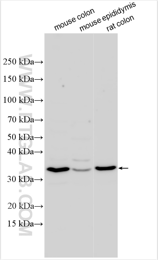 WB analysis using 31552-1-AP