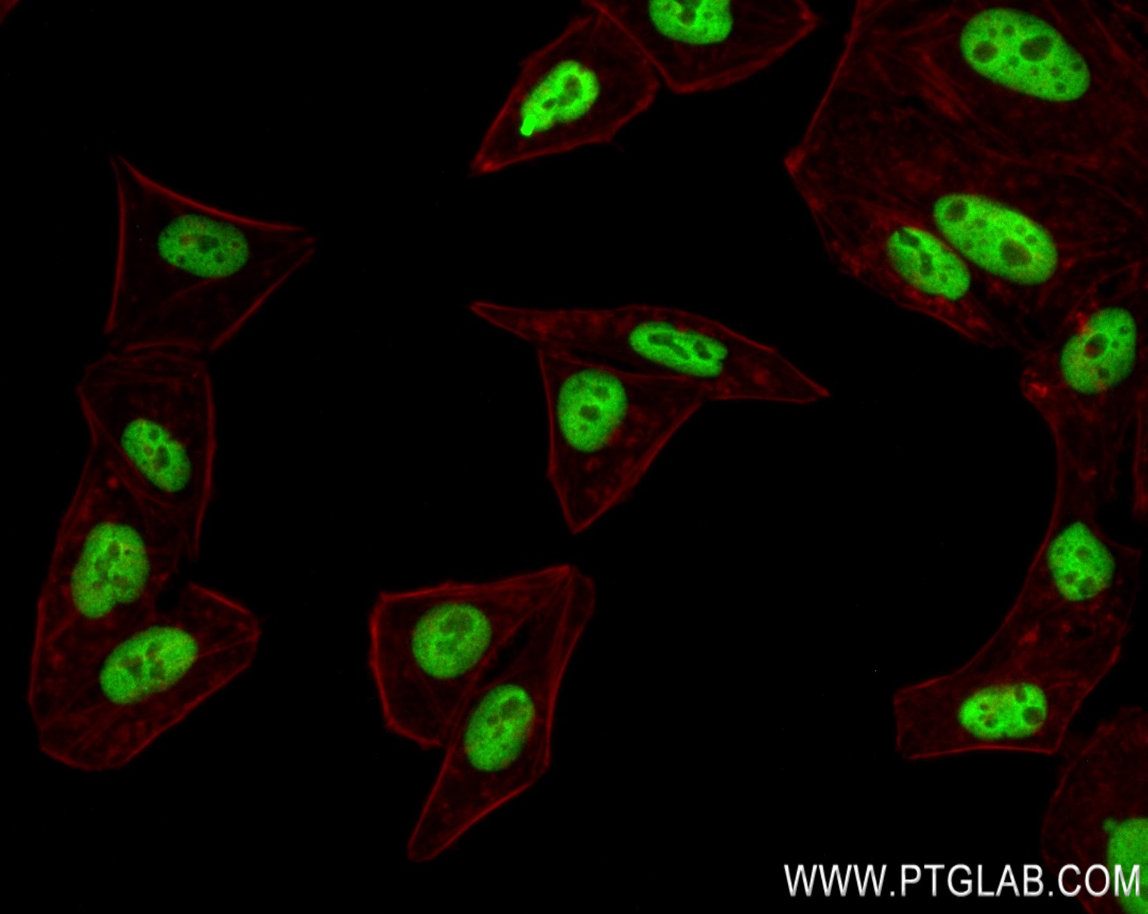 IF Staining of HepG2 using 83155-4-RR (same clone as 83155-4-PBS)