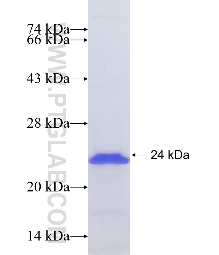 HOXB6 fusion protein Ag39469 SDS-PAGE