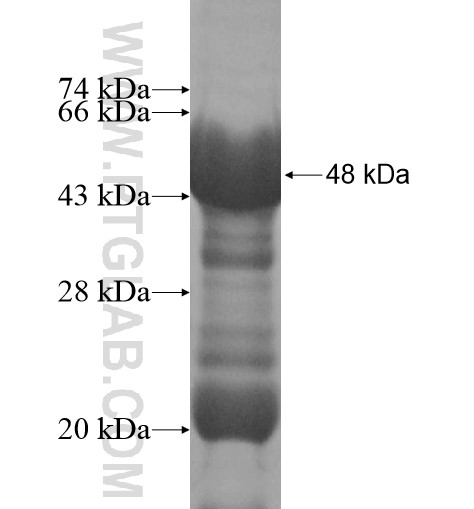 HOXB6 fusion protein Ag14189 SDS-PAGE