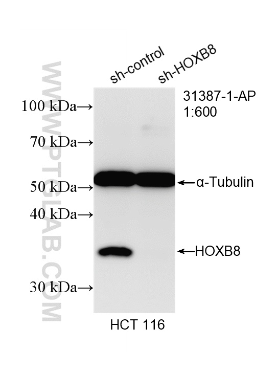 WB analysis of HCT 116 using 31387-1-AP WB analysis of HCT 116 using 31387-1-AP