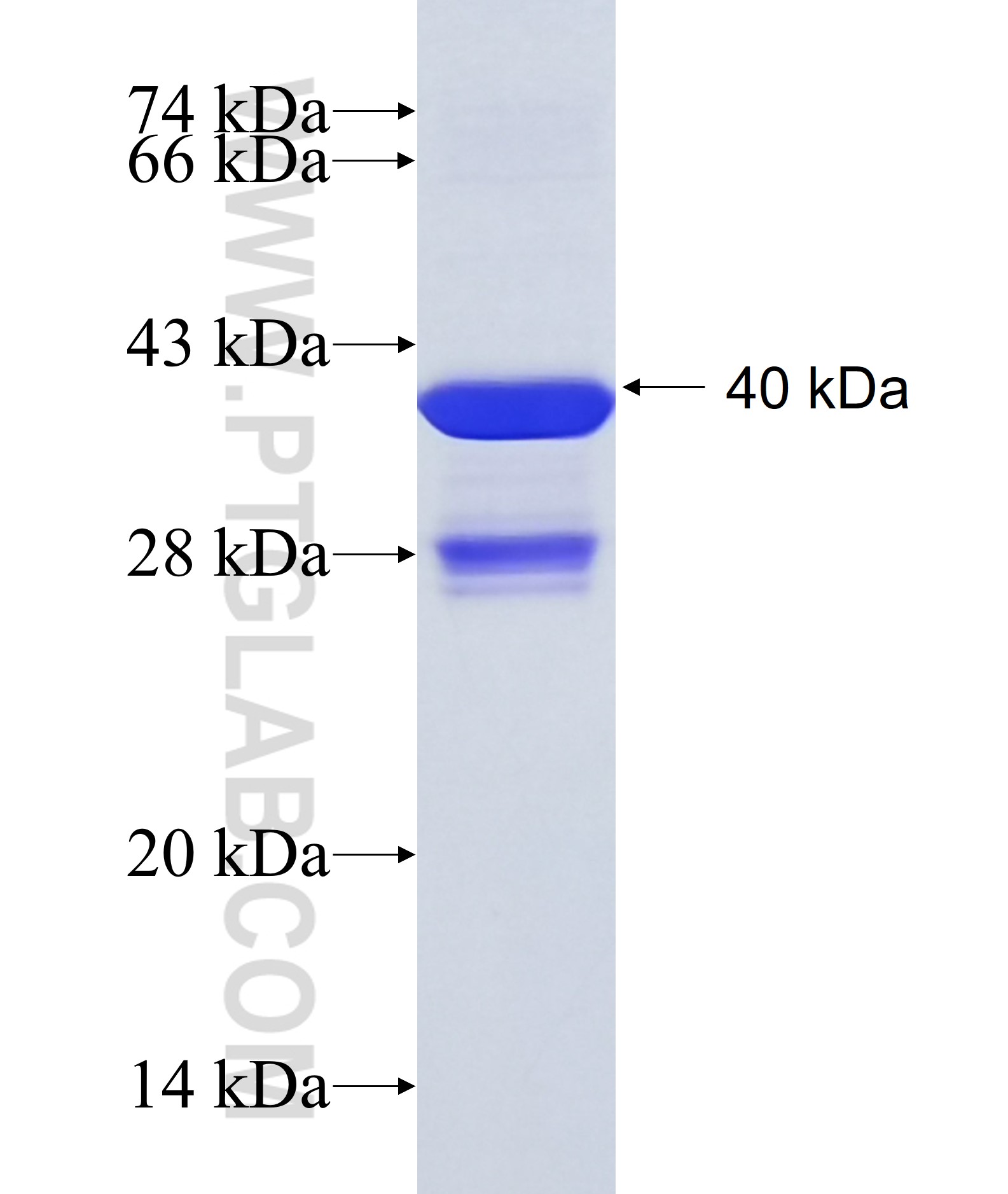 HOXB8 fusion protein Ag34946 SDS-PAGE HOXB8 fusion protein Ag34946 SDS-PAGE