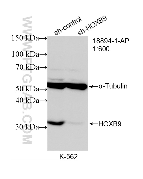 WB analysis of K-562 using 18894-1-AP (same clone as 18894-1-PBS)