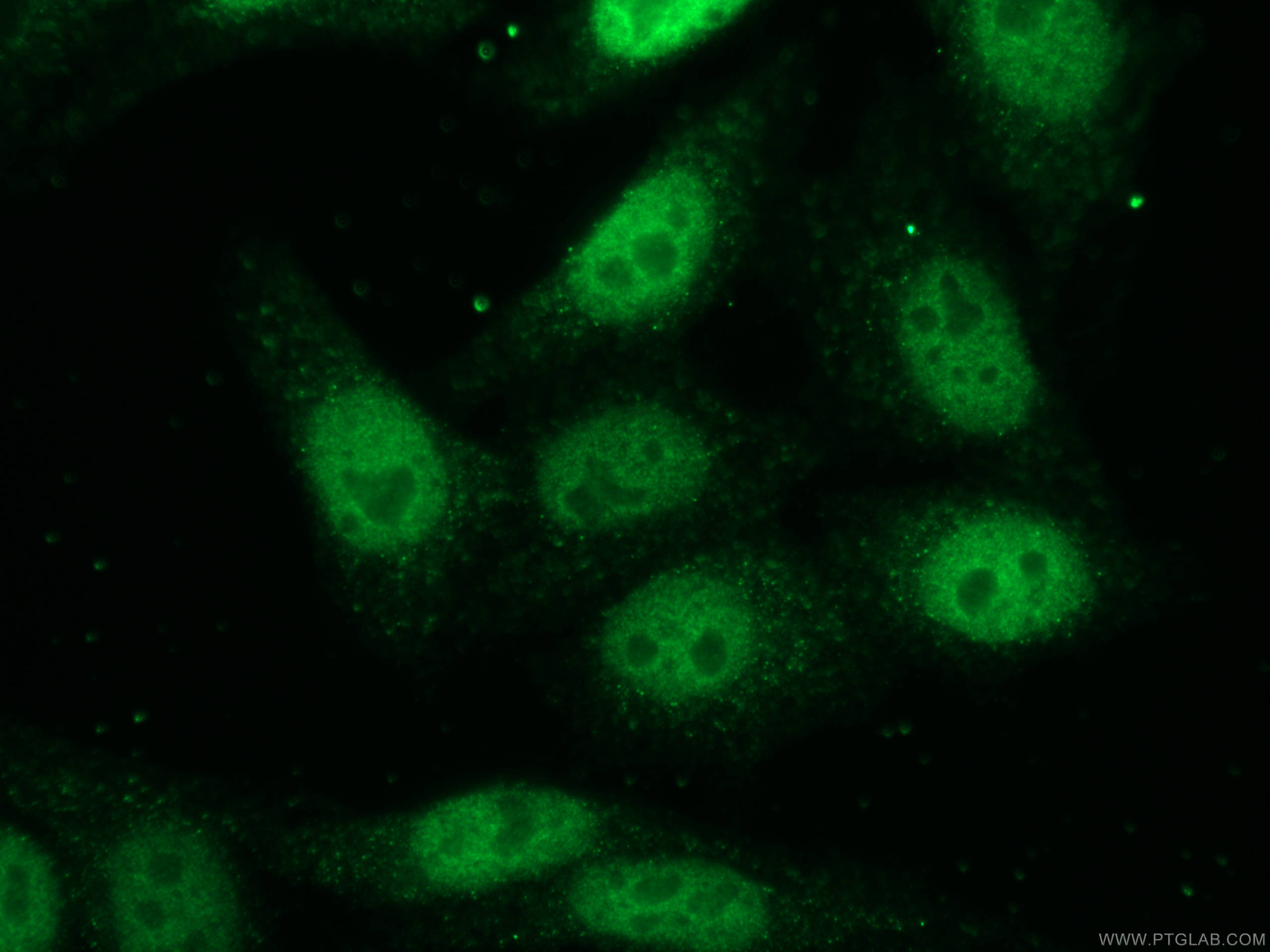 IF Staining of HepG2 using 12025-1-AP (same clone as 12025-1-PBS)