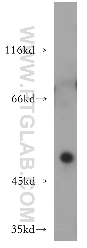 WB analysis of mouse heart using 12025-1-AP (same clone as 12025-1-PBS)