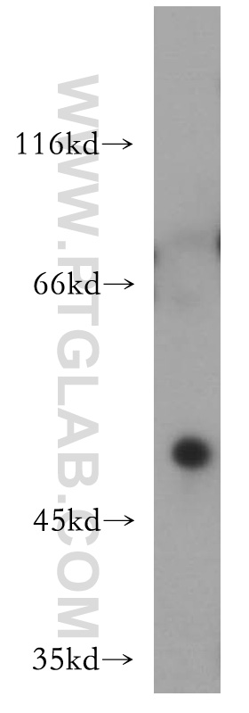 WB analysis of mouse heart using 12025-1-AP