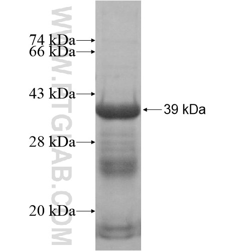 HOXC10 fusion protein Ag14608 SDS-PAGE HOXC10 fusion protein Ag14608 SDS-PAGE