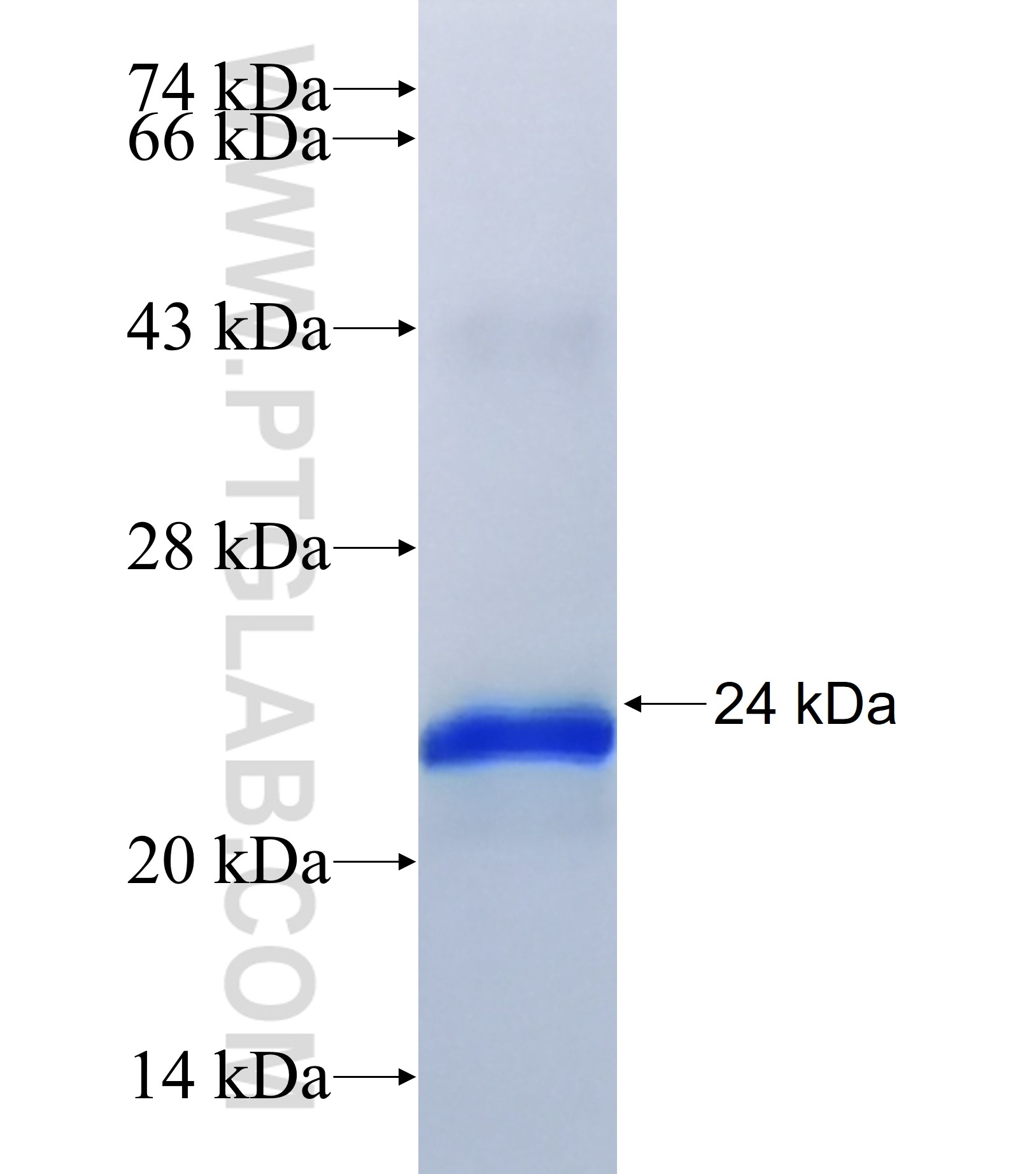 HOXC11 fusion protein Ag17891 SDS-PAGE HOXC11 fusion protein Ag17891 SDS-PAGE