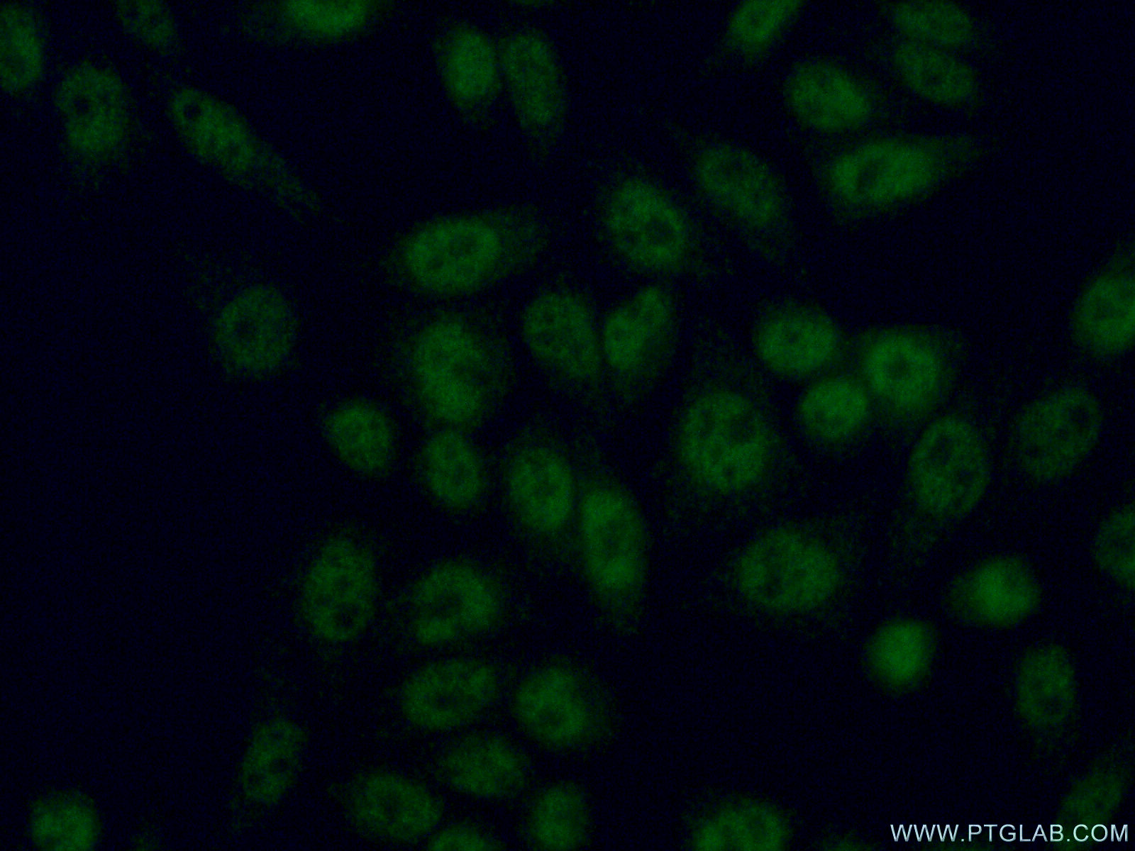 IF Staining of HeLa using 14321-1-AP