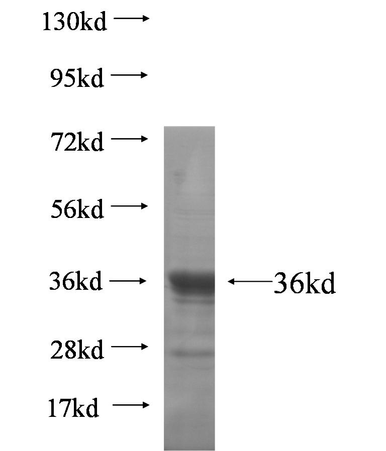 HOXC4 fusion protein Ag5548 SDS-PAGE
