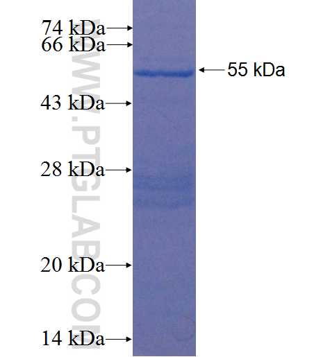 HOXC9 fusion protein Ag22527 SDS-PAGE
