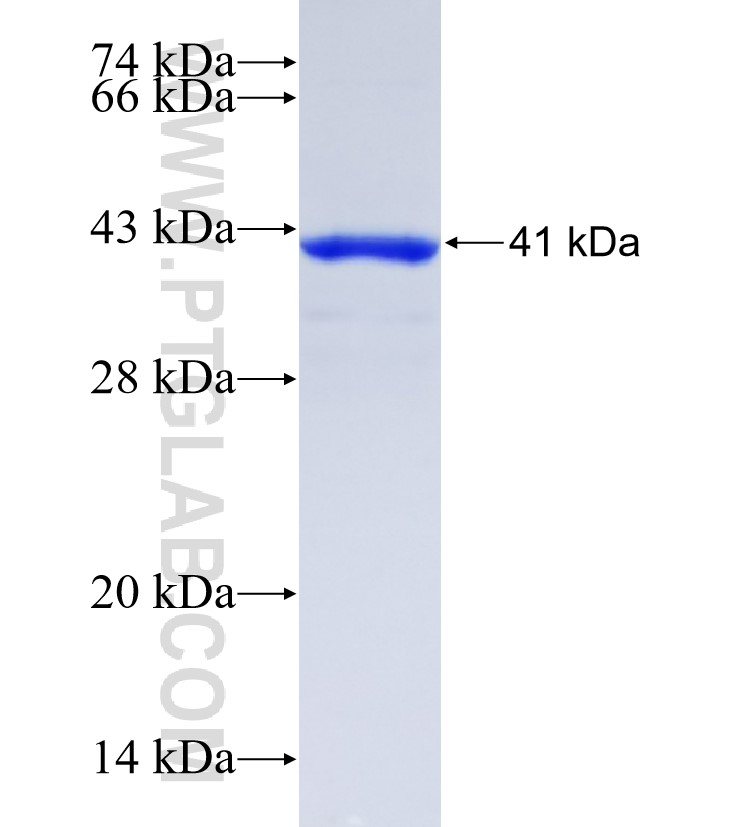 HOXD10 fusion protein Ag24196 SDS-PAGE