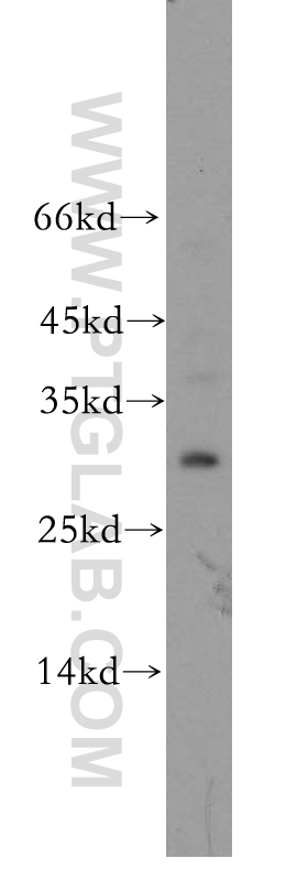 WB analysis of mouse liver using 18735-1-AP