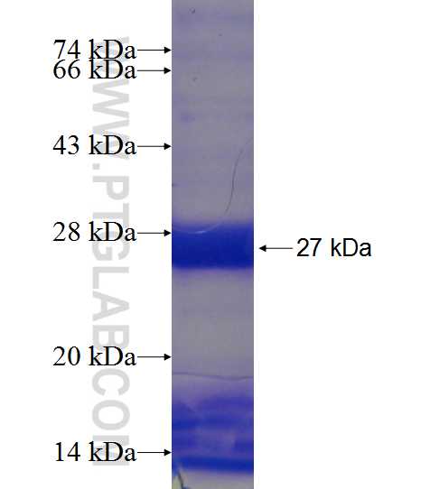 HOXD12 fusion protein Ag18675 SDS-PAGE HOXD12 fusion protein Ag18675 SDS-PAGE