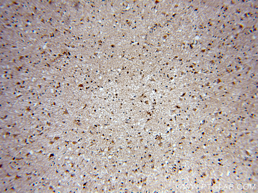 IHC staining of human brain using 18736-1-AP