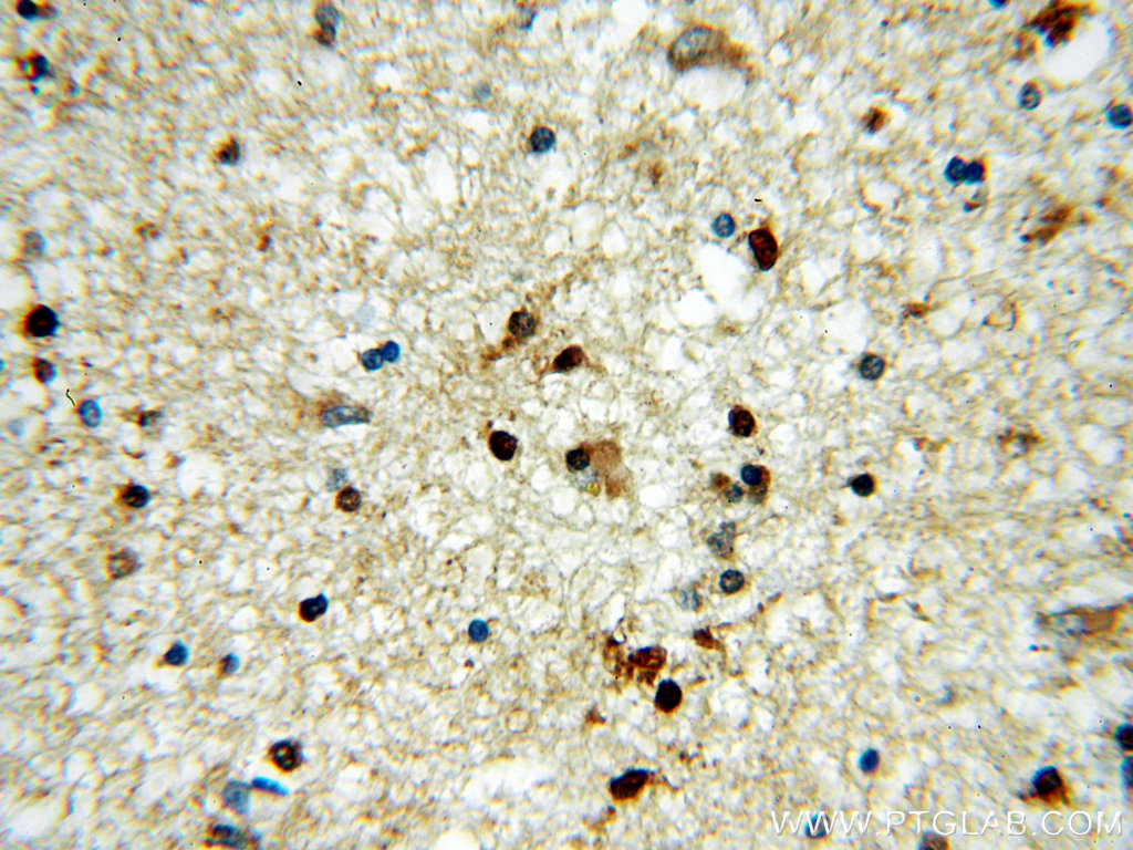 IHC staining of human brain using 18736-1-AP