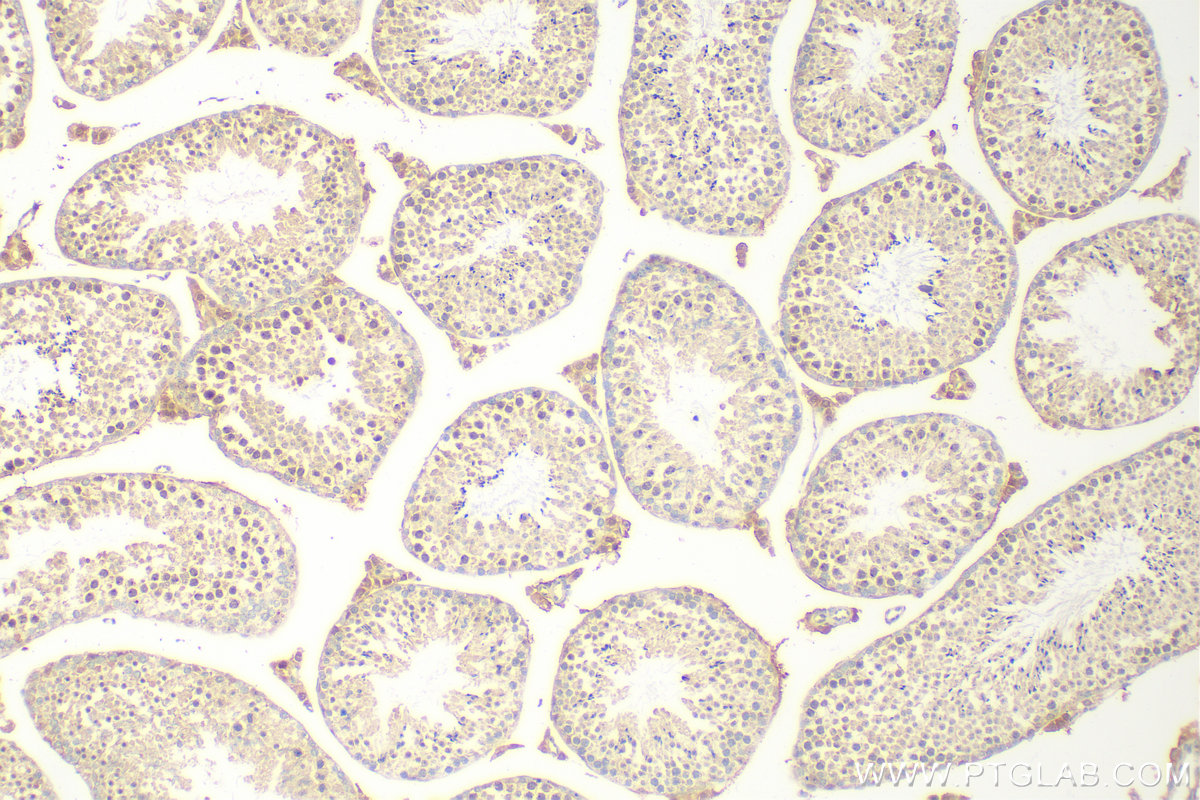 IHC staining of mouse testis using 10496-1-AP (same clone as 10496-1-PBS)