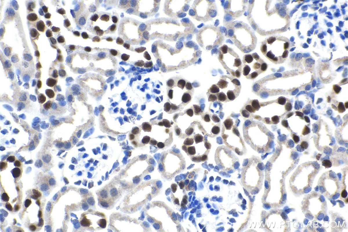IHC staining of mouse kidney using 18588-1-AP (same clone as 18588-1-PBS)