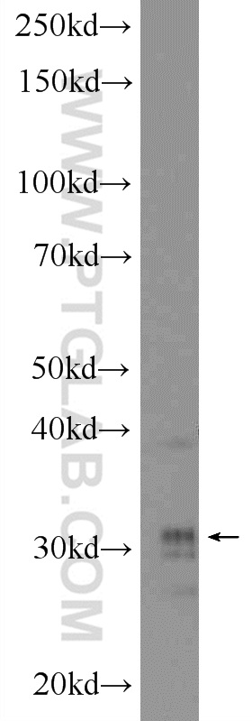 HOXD8 Polyclonal antibody