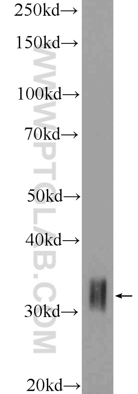 HOXD8