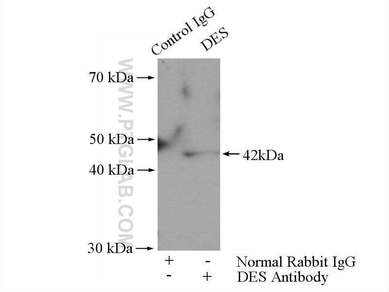 IP experiment of HepG2 using 16665-1-AP
