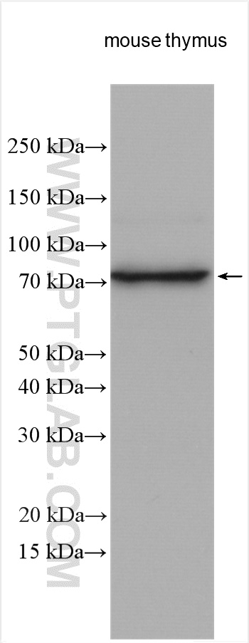 WB analysis using 24556-1-AP