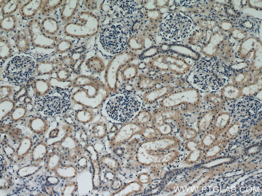 IHC staining of human kidney using 10989-1-AP