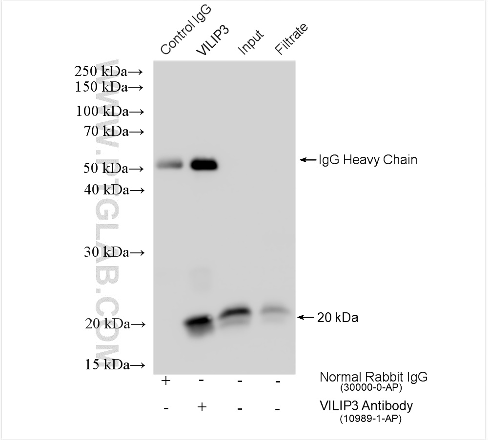 IP experiment of mouse brain using 10989-1-AP