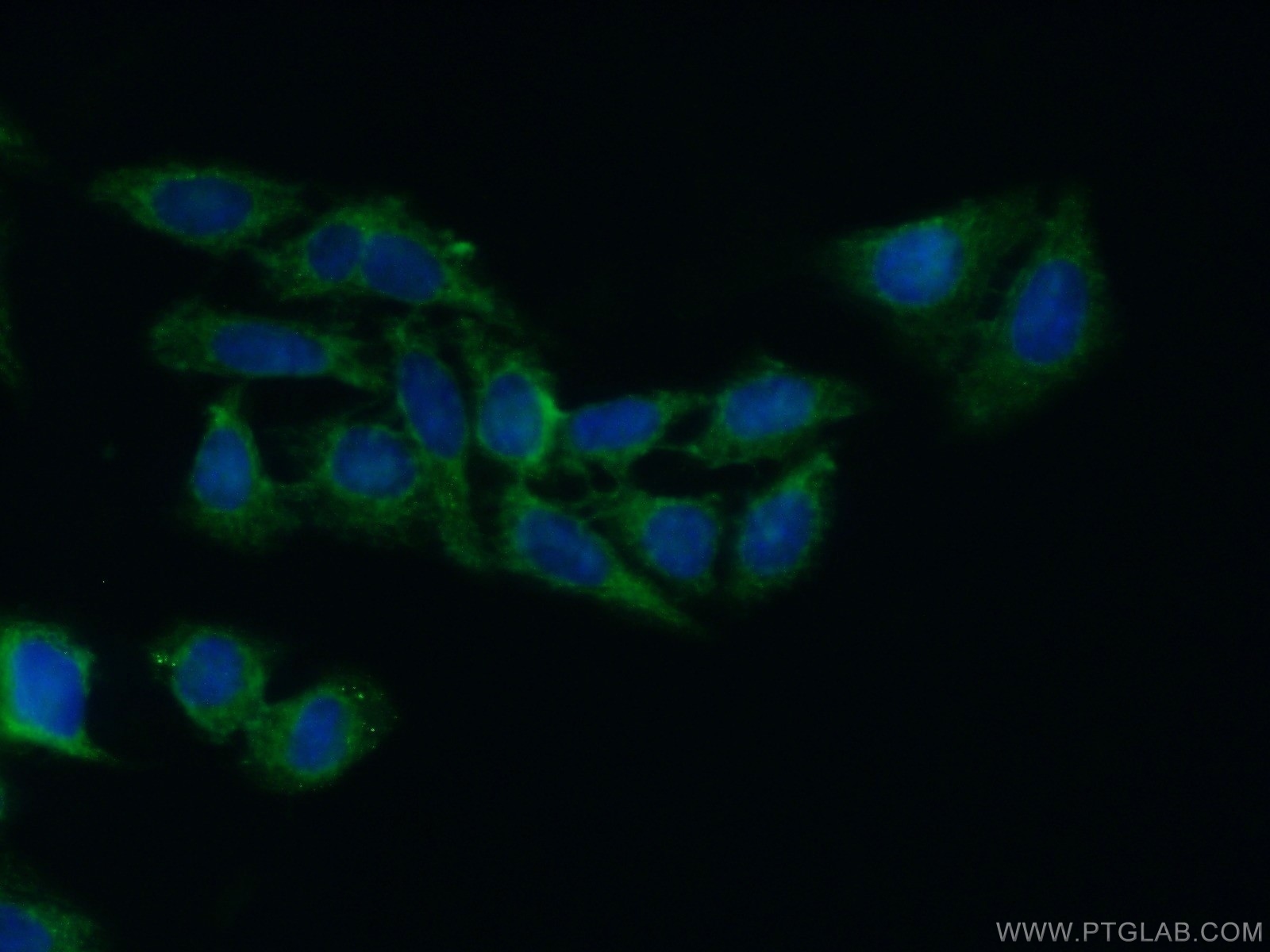 IF Staining of HepG2 using 17004-1-AP