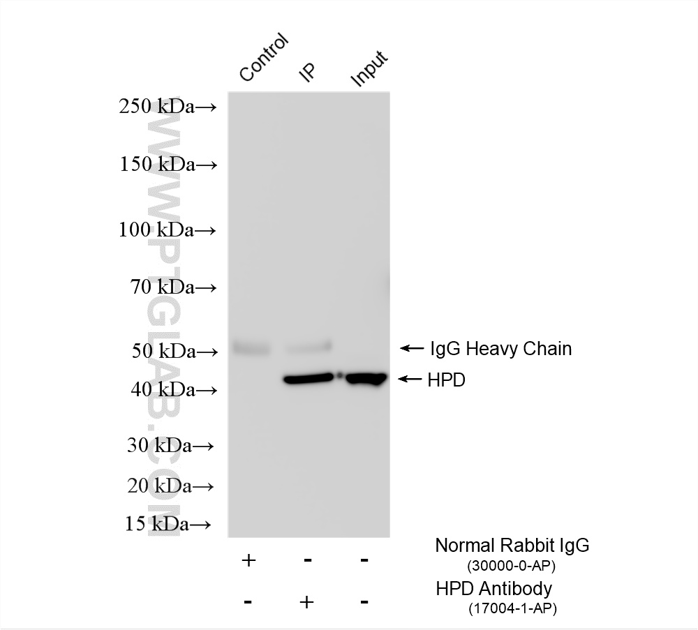 IP experiment of HepG2 using 17004-1-AP IP experiment of HepG2 using 17004-1-AP